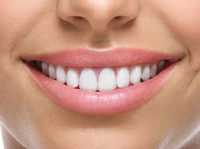 Dental Beauty Swanley (8) - Zobārsti