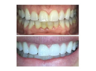 Idahome Smiles (4) - Dentists