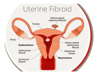 USA Fibroid Centers (3) - Spitale şi Clinici