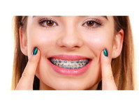 Braces Orthodontics Pediatrics - bop BRACES (2) - Zubní lékař