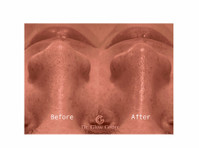 Dr. Glow Getter (5) - Beauty Treatments