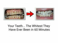 Rock Star Teeth Whitening (3) - Dentists