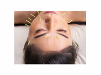 Beth Conroy Acupuncture - Alternativní léčba
