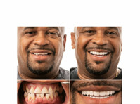 Jax Dental Implants & Dentures (2) - Zubní lékař