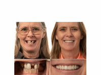 Jax Dental Implants & Dentures (3) - Dentists