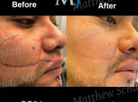 Matthew Schulman, MD (5) - Cosmetic surgery