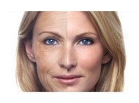 Transform Medspa | Liposuction, Body Treatments (2) - Третмани за убавина