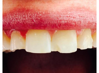 Chips Dental Associates Llc (1) - ڈینٹسٹ/دندان ساز