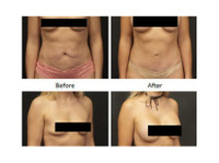The Gallery of Cosmetic Surgery (1) - Cosmetic surgery