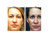 The Gallery of Cosmetic Surgery (2) - Cosmetic surgery