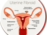 USA Fibroid Centers (3) - Slimnīcas un klīnikas