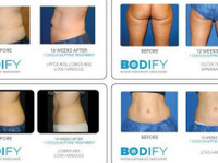 Bodify (1) - Beauty Treatments