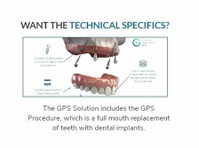 Dental Implants Gps (1) - Dentistes