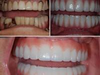 Daniel B. Balaze, dmd, fgd & william y gregg, ddS, fagd (2) - Dentists