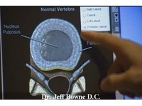 Bowne Chiropractic (2) - Алтернативно лечение