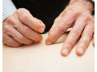 Gracey Holistic Health (8) - Acupuncture