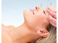 Perfect Union Mind & Body Acupuncture (1) - ہیلتھ انشورنس/صحت کی انشورنس
