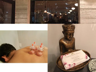 best acupuncture nyc (1) - Akupunktio