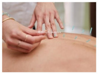 Hima Acupuncture (1) - Alternative Heilmethoden