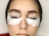 Dolce Derma - Facials Skincare and Lashes (5) - صحت اور خوبصورتی