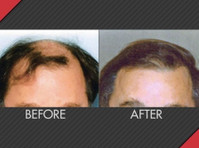 Maxim Hair Restoration (2) - Третмани за убавина