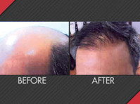 Maxim Hair Restoration (4) - Третмани за убавина