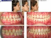 Ismile Specialists (5) - Zubní lékař