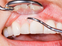 smileperfectors (1) - Dentists