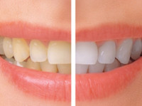 smileperfectors (3) - Dentists