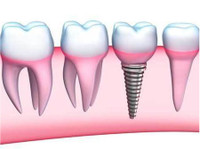 smileperfectors (5) - Dentists