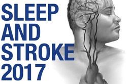 Mayo Clinic Sleep and Stroke 2017