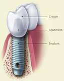 Free workshop for dental implant dentist