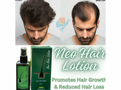Neo Hair Lotion price In Pakistan | 03222076662 - Labor